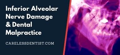 Inferior Alveolar Nerve Damage Dental Malpractice Florida Dental