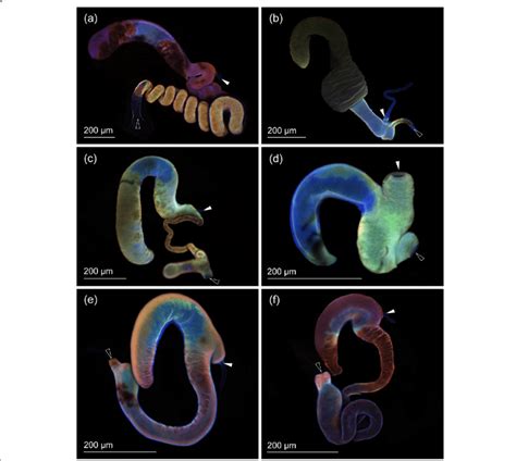 Confocal Laser Scanning Micrographs Of Spermathecae The White