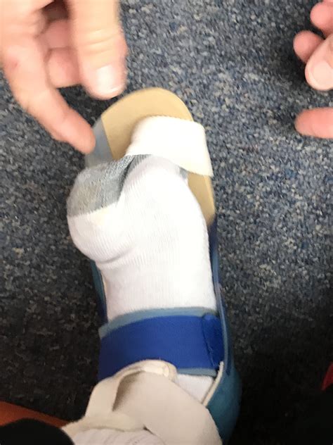 Brilliant Therapy | AFO Don & Doff