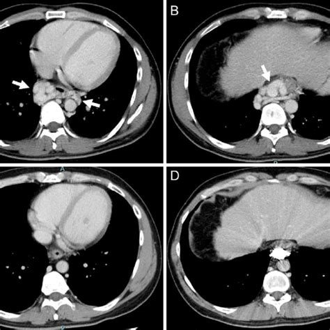 Figure1 A B Dynamic Contrast Enhanced Computed Tomography Ct Download Scientific Diagram