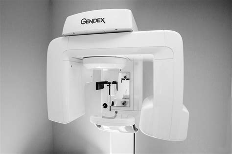 Orthopantomogram ᐉ Panoramic shot of the teeth ᐉ Orthopantomograph OPG