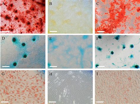 Representative Images Showing Staining With Alizarin Red A B C