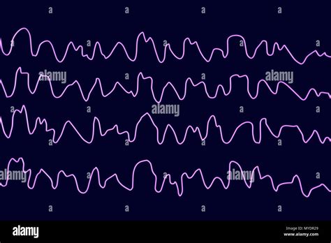 Cerebro Y Ondas Cerebrales Fotografías E Imágenes De Alta Resolución