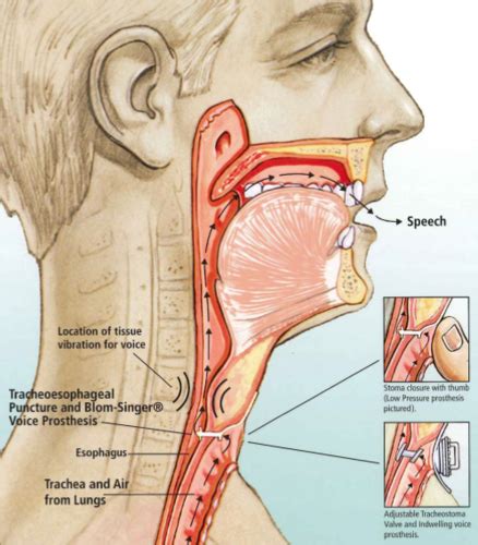 Dysphagia Week 5 Flashcards Quizlet