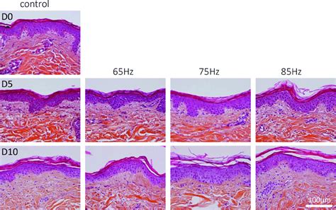 Haematoxylin Eosin Stain Safran Hes Histological Pictures Of