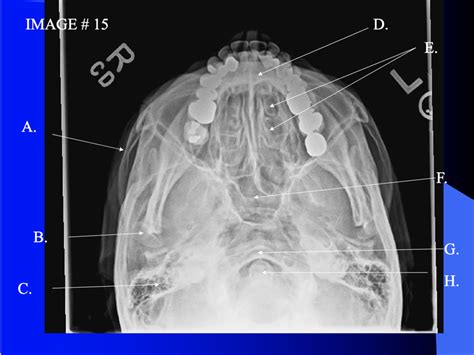 SMV SINUS LABELING Diagram Quizlet