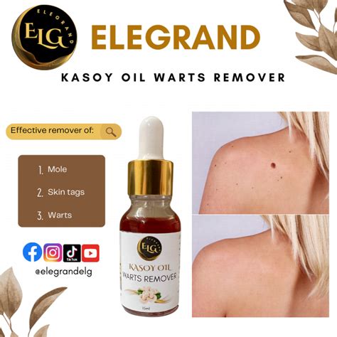 Elegrand Pure And Organic Kasoy Oil Warts Remover Herbal Nunal Remover