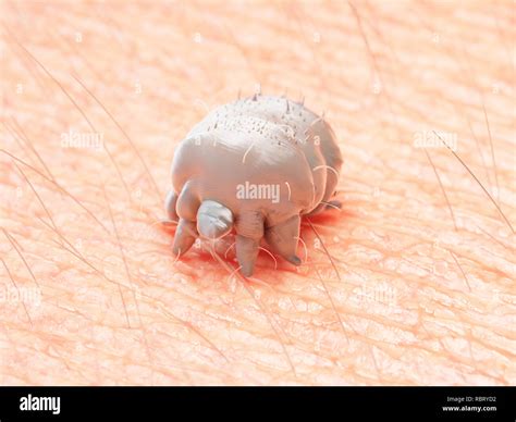 Illustration Of A Scabies Mite Stock Photo Alamy