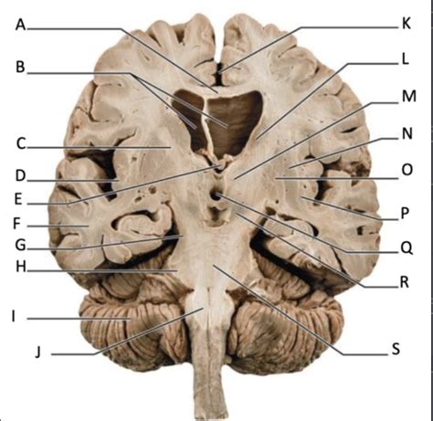 Neuro Lab Exam Key Terms Definitions For Music Study Flashcards