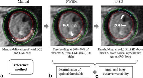 Myocardial Infarct Sizing By Late Gadolinium‐enhanced Mri Comparison