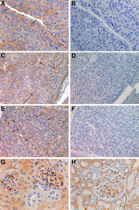 Cd Staining Demonstrates That Ecs In Human Hcc Xenografts Within The