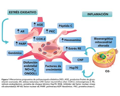 Neuropat A Diab Tica Epidemiolog A Clasificaci N Fisiopatolog A Y