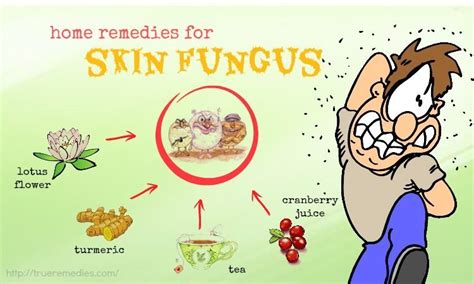 21 Home Remedies For Skin Fungus On Hands, Thighs & Legs