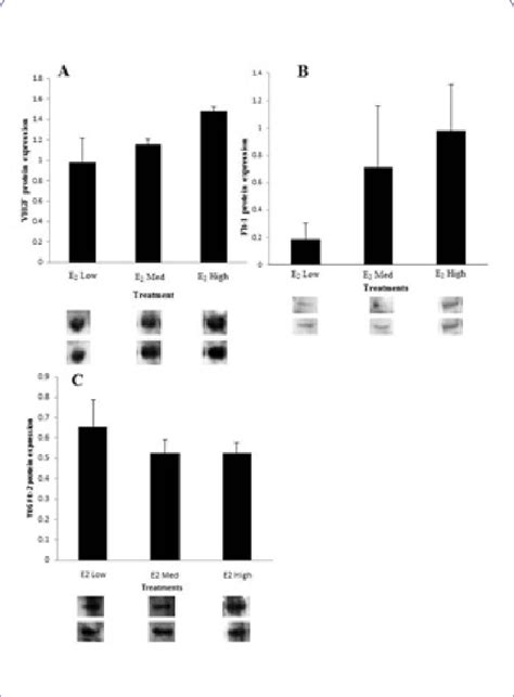 Effects of 17β estradiol on expression of VEGF VEGFR 2 and Flt 1