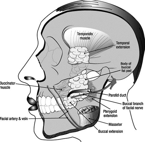 Pedicled Buccal Fat Pad In The Management Of Oroantral Fistula A