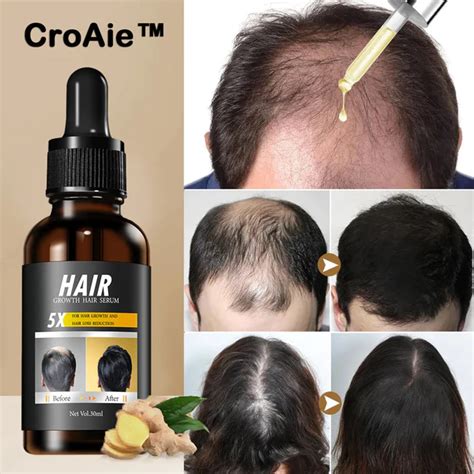 Croaie Rapid Hair Growth Serum Wizzgoo Shop