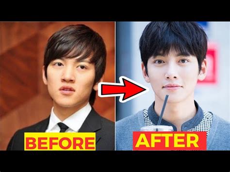 Korean Celebrity Before And After Plastic Surgery