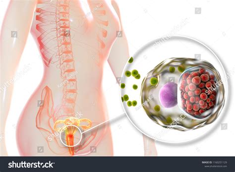 Female Chlamydiosis Medical Concept 3d Illustration Stock Illustration