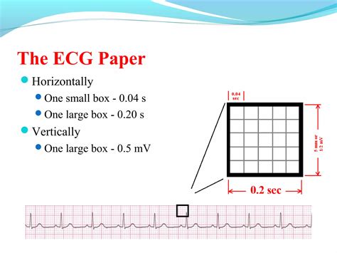 Basics Of Electrocardiographyecg Ppt