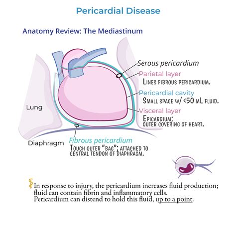 USMLE COMLEX Step 1 Glossary Pericardial Disease For USMLE Step 1