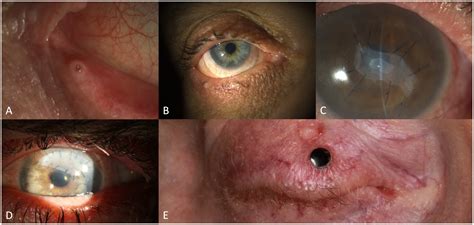 Frontiers Challenges And Concepts In The Diagnosis And Management Of