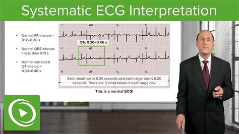 Systematic Ecg Interpretation Cardiology Lecturio Youtube