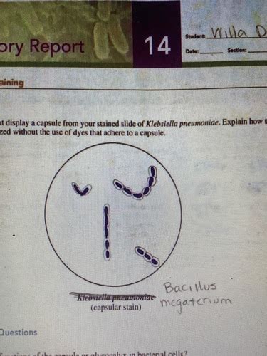 Lab Final Spore And Capsular Stain Flashcards Quizlet