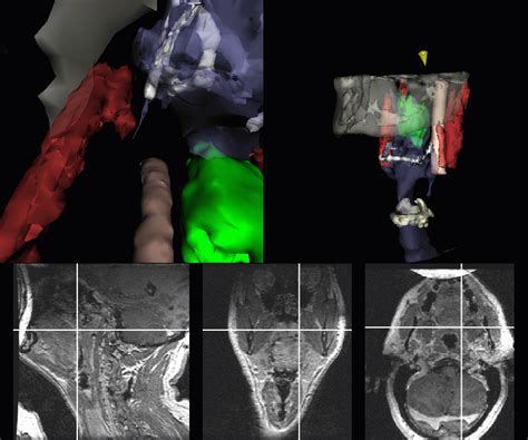 Endoscopic Navigation