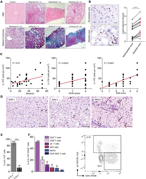 NKG2D Mediated Detection Of Metabolically Stressed Hepatocytes By