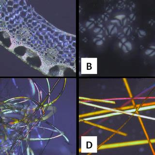 (PDF) Polarized Light Microscopy