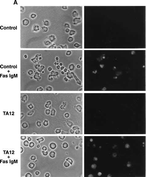 Membrane And Morphological Changes In Apoptotic Cells Regulated By