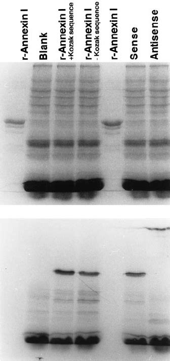 In Vitro Transcription And Translation Of Annexin I Cdna And Of Genomic