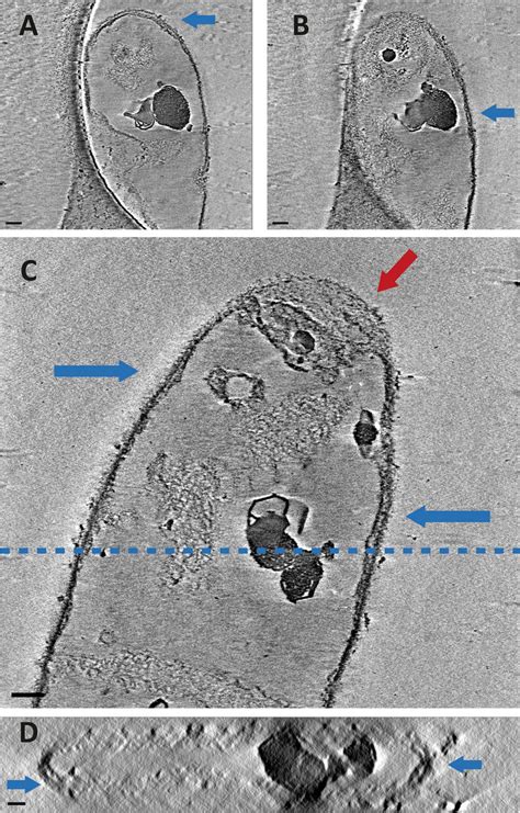 Cryo ETs Of HF Treated S Coelicolor WT Sacculi Show Double Layers Of