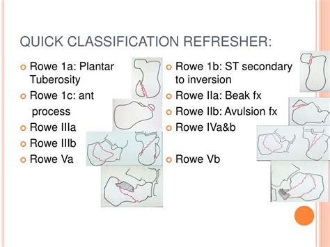 Calcaneal Fracture Classification