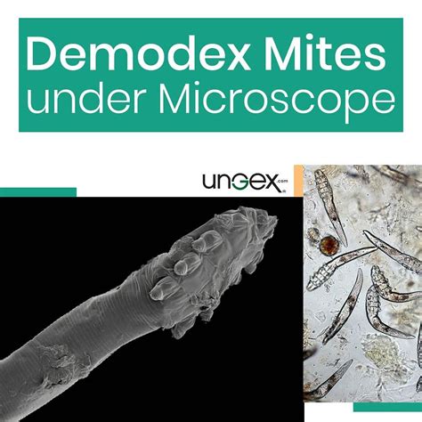 Demodex mites under the microscope – Artofit