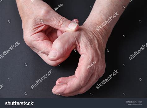 Thumb arthritis Images, Stock Photos & Vectors | Shutterstock