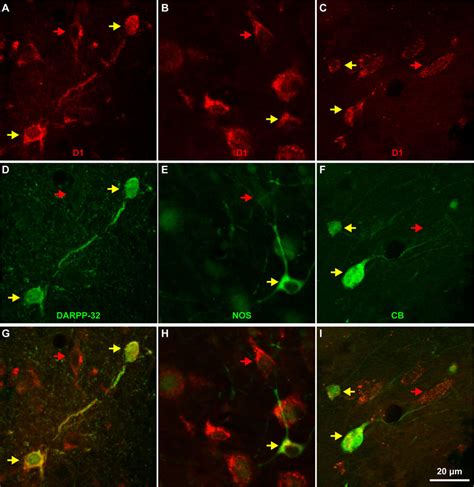 All Neurons Of Three Distinct Neurochemical Subtypes Of Darpp 32 Nos