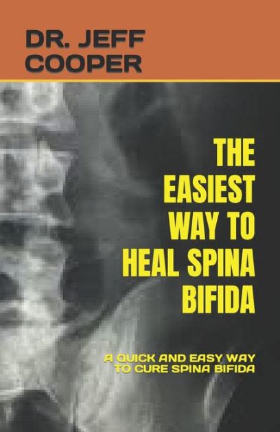 The Easiest Way To Heal Spina Bifida A Quick And Easy Way To Cure