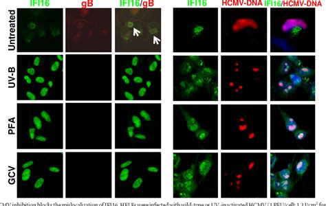 Figure 3 From Virions During The Late Stage Infection And Is Entrapped