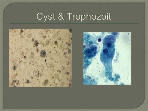 Entamoeba Histolytica Trophozoite And Cyst