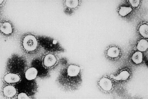 Iowa Confirms First 3 Presumptive Coronavirus Cases