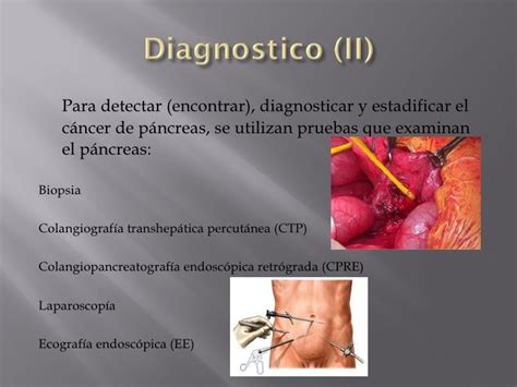 Cancer De Pancreas