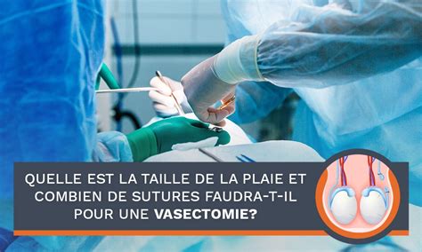 Combien De Sutures Vais Je Avoir Besoin Pour Une Vasectomie