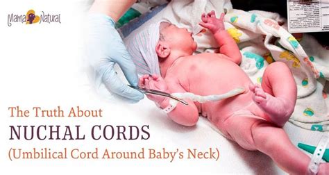 The Truth About Nuchal Cords Umbilical Cord Around Babys Neck Baby