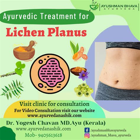 Lichen Planus Ayurvedic Treatmentdryogesh Chavanmdayukeralay