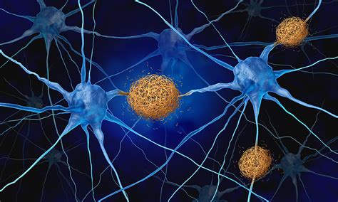 press releases arup laboratories