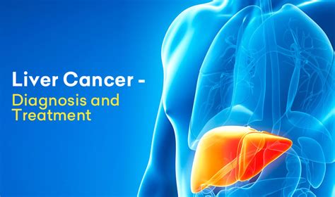 Liver Cancer Diagnosis And Treatment Cancer Healer Center