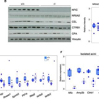 Nfic Is Required For Normal Acinar Cell Differentiation A The Pancreas