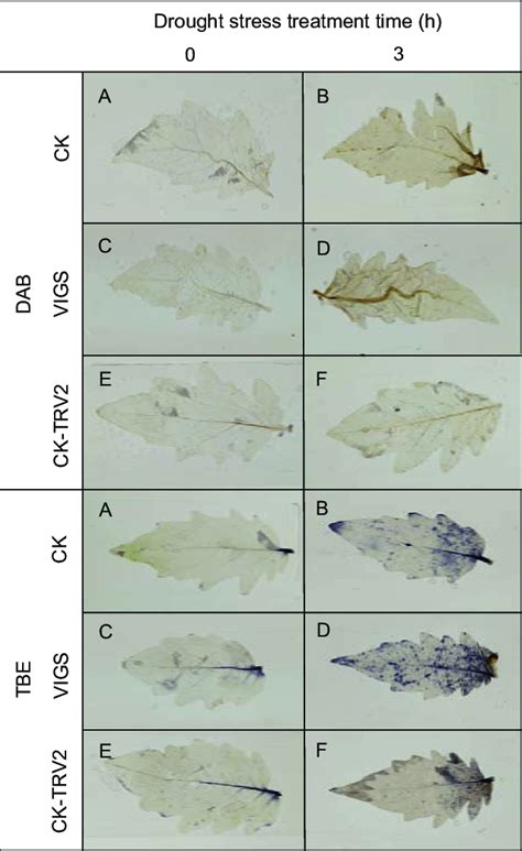 Nitroblue Tetrazolium Nbt And Diaminobenzidine Dab Staining