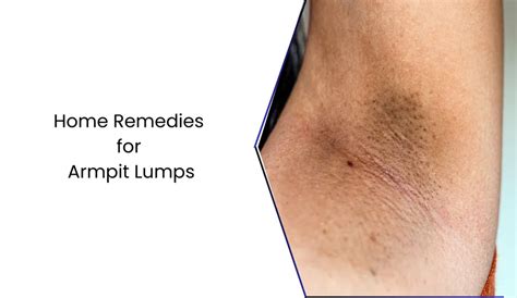 home remedies  armpit lumps  cures